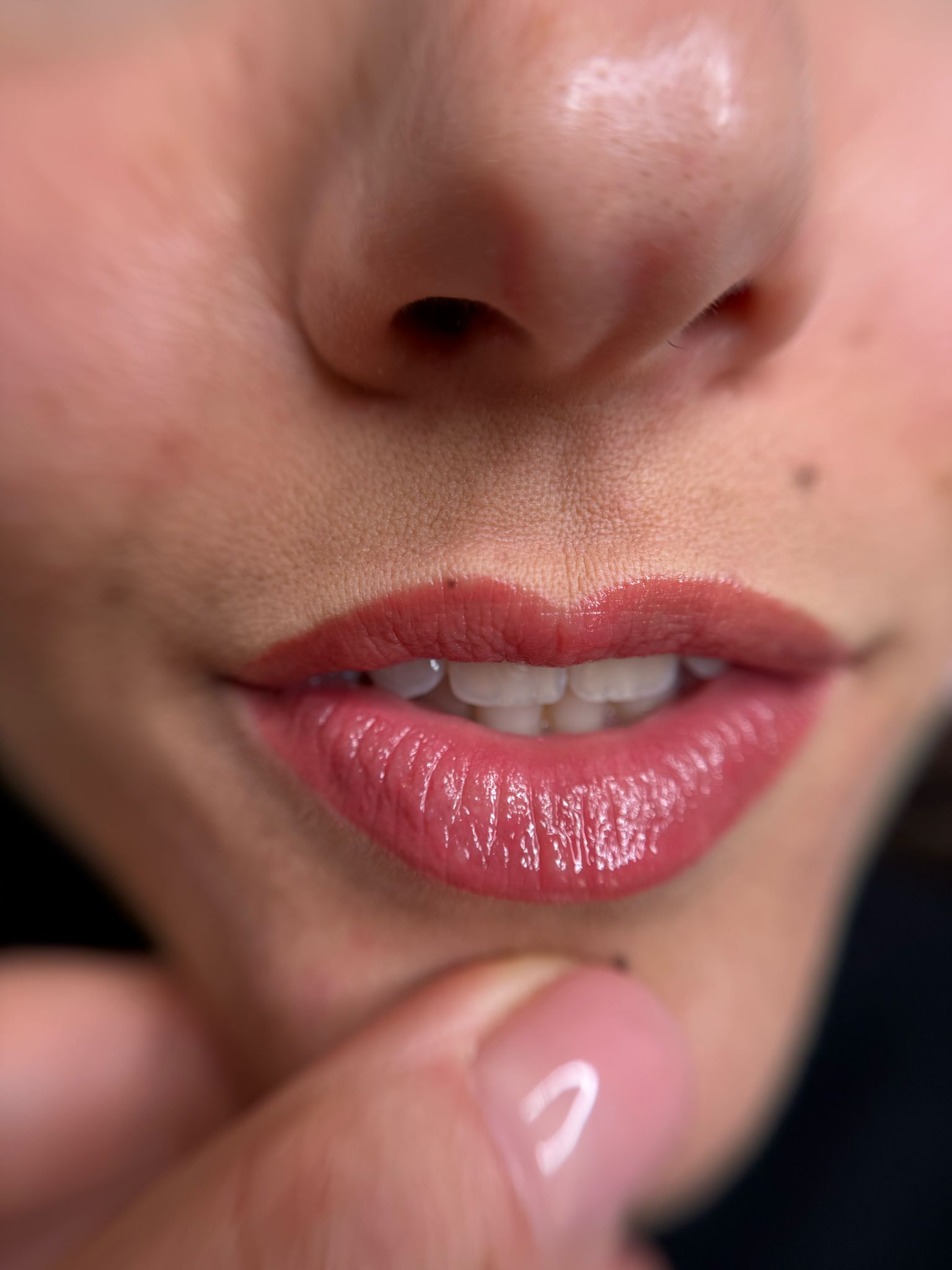 lips 3